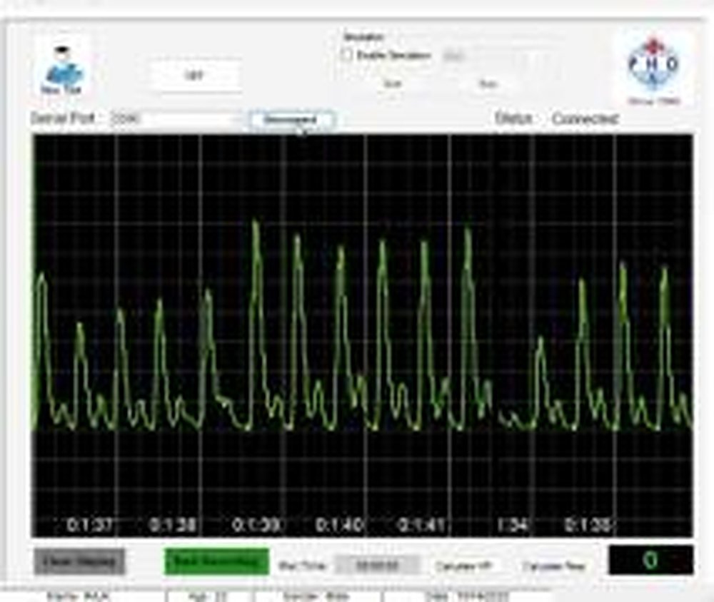 Plethysmograph (Doppler)